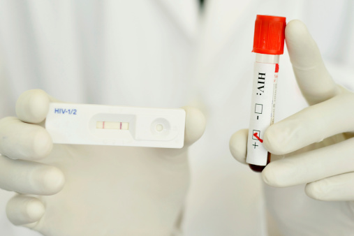 Making HIV Testing More Effective